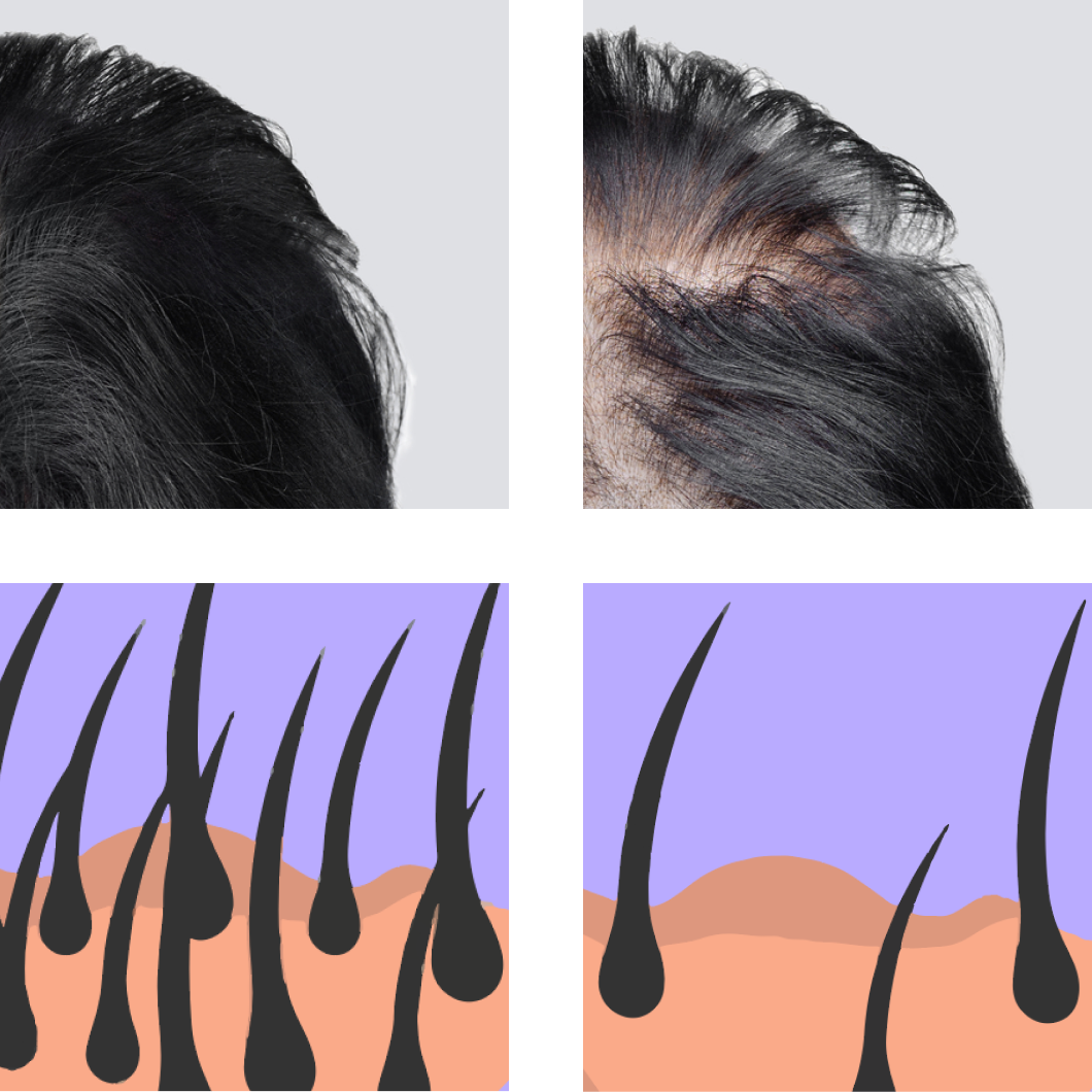 Hair and Fossicles