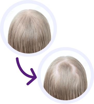 Hair Comparison