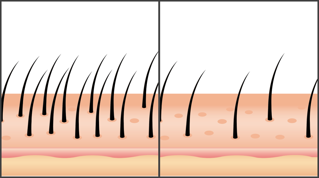 Hair Fossicles